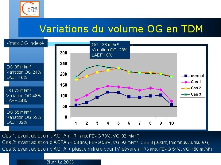 Variations du volume OG en TDM Vmax OG indexé OG 133 ml/m² Variation OG