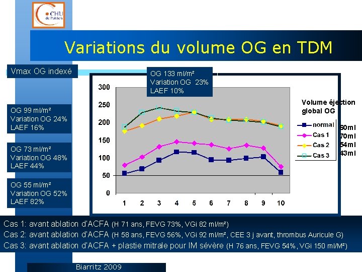 Variations du volume OG en TDM Vmax OG indexé OG 133 ml/m² Variation OG