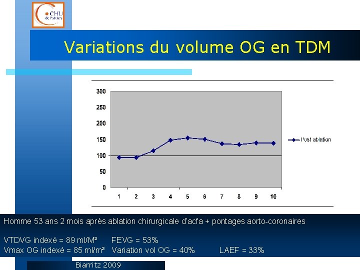 Variations du volume OG en TDM Homme 53 ans 2 mois après ablation chirurgicale