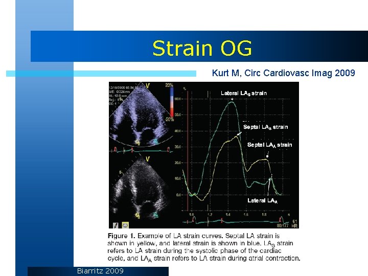 Strain OG Kurt M, Circ Cardiovasc Imag 2009 Biarritz 2009 