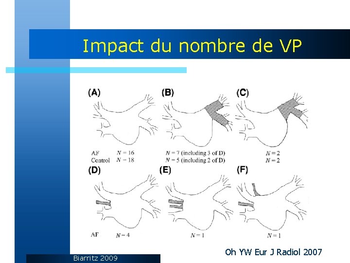 Impact du nombre de VP Biarritz 2009 Oh YW Eur J Radiol 2007 