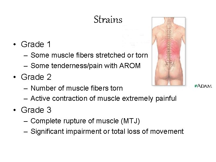 Strains • Grade 1 – Some muscle fibers stretched or torn – Some tenderness/pain