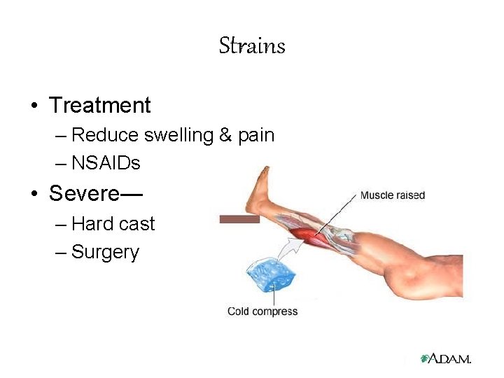 Strains • Treatment – Reduce swelling & pain – NSAIDs • Severe— – Hard