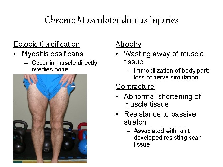 Chronic Musculotendinous Injuries Ectopic Calcification • Myositis ossificans – Occur in muscle directly overlies