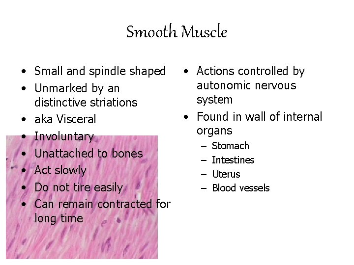 Smooth Muscle • Small and spindle shaped • Unmarked by an distinctive striations •