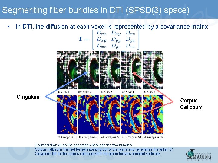 Segmenting fiber bundles in DTI (SPSD(3) space) • In DTI, the diffusion at each