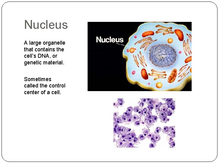 Nucleus A large organelle that contains the cell’s DNA, or genetic material. Sometimes called