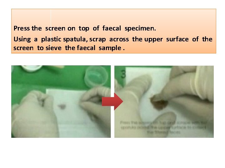 Press the screen on top of faecal specimen. Using a plastic spatula, scrap across