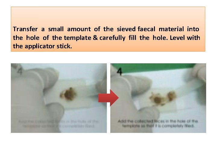 Transfer a small amount of the sieved faecal material into the hole of the
