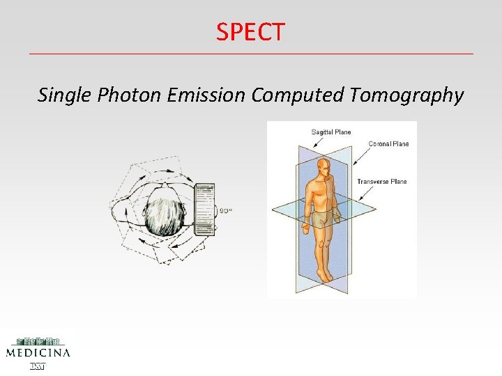 SPECT Single Photon Emission Computed Tomography 