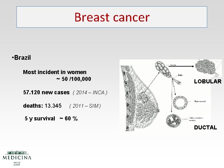 Breast cancer • Brazil Most incident in women ~ 50 /100, 000 LOBULAR 57.