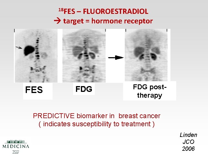 18 FES – FLUOROESTRADIOL target = hormone receptor FES FDG posttherapy PREDICTIVE biomarker in