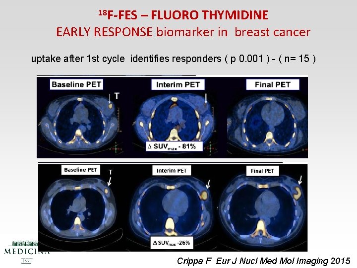 18 F-FES – FLUORO THYMIDINE EARLY RESPONSE biomarker in breast cancer uptake after 1