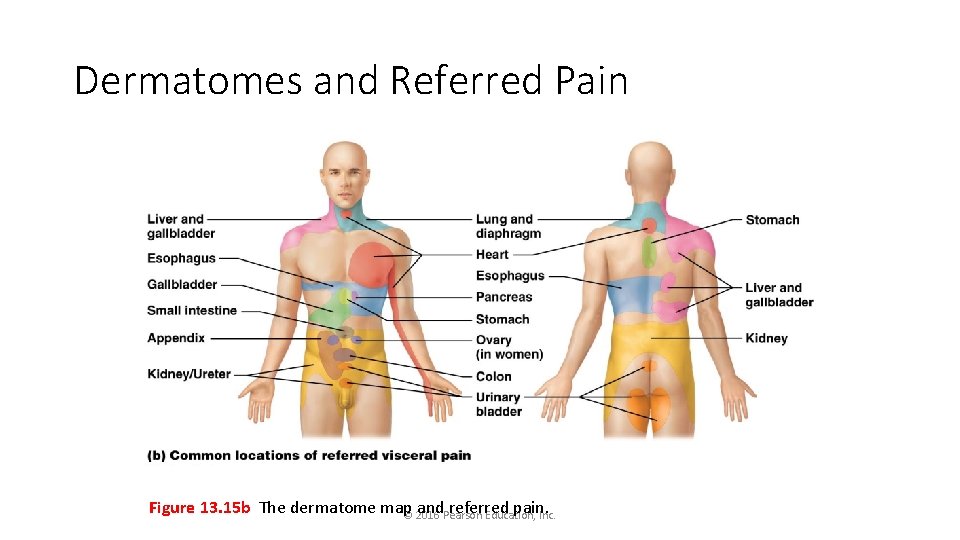 Dermatomes and Referred Pain Figure 13. 15 b The dermatome map and. Pearson referred