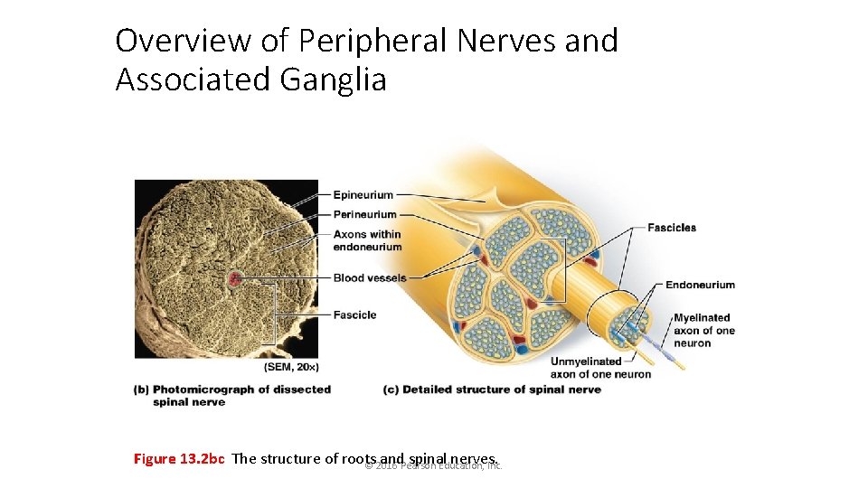 Overview of Peripheral Nerves and Associated Ganglia Figure 13. 2 bc The structure of