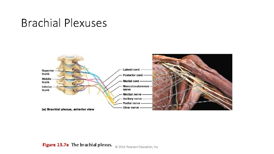 Brachial Plexuses Figure 13. 7 a The brachial plexus. © 2016 Pearson Education, Inc.