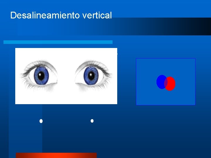 Desalineamiento vertical 3 D image fails, or may cause eye-strain. 