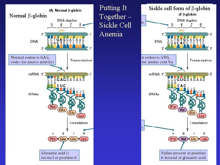 Normal -globin Putting It Together – Sickle Cell Anemia Sickle cell form of -globin