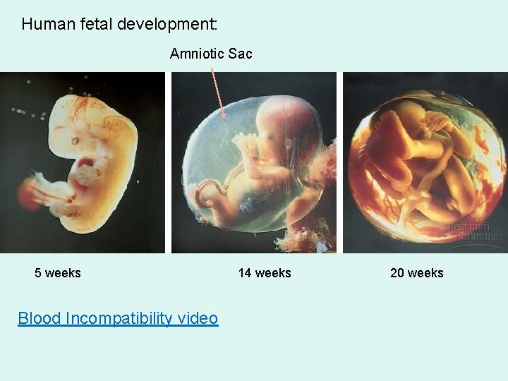 Human fetal development: Amniotic Sac 5 weeks Blood Incompatibility video 14 weeks 20 weeks