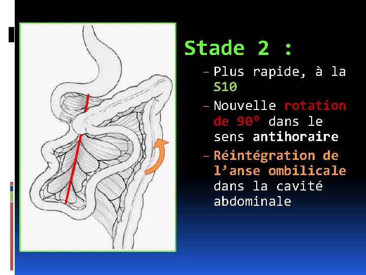 Stade 2 : – Plus rapide, à la S 10 – Nouvelle rotation de