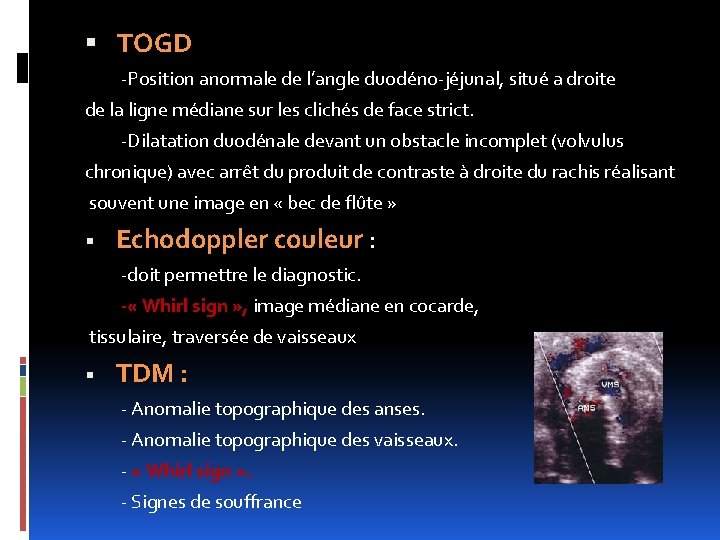  TOGD -Position anormale de l’angle duodéno-jéjunal, situé a droite de la ligne médiane