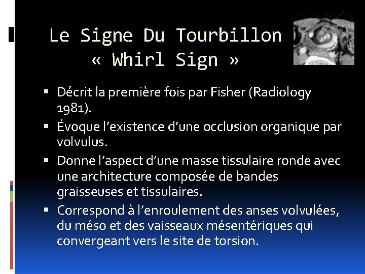 Le Signe Du Tourbillon « Whirl Sign » Décrit la première fois par Fisher