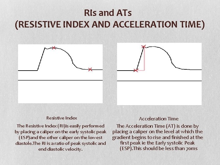 RIs and ATs (RESISTIVE INDEX AND ACCELERATION TIME) Resistive Index Acceleration Time The Resistive