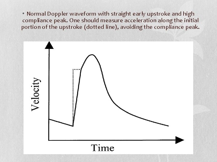  • Normal Doppler waveform with straight early upstroke and high compliance peak. One