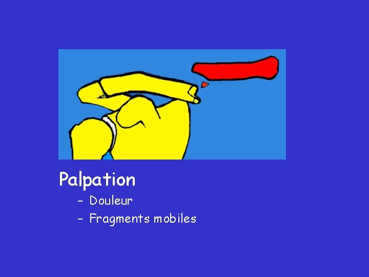 Palpation – Douleur – Fragments mobiles 