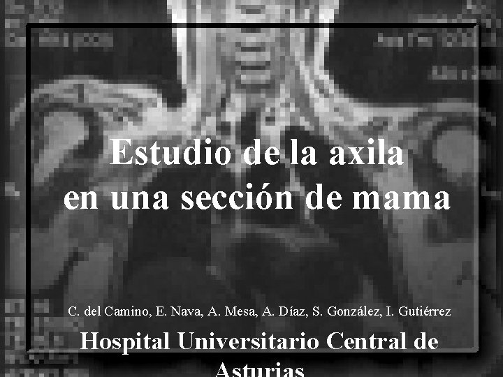 Estudio de la axila en una sección de mama C. del Camino, E. Nava,