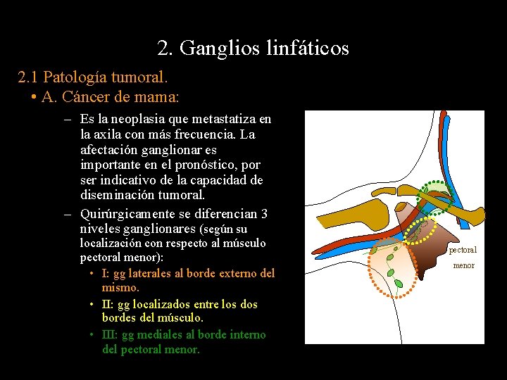 2. Ganglios linfáticos 2. 1 Patología tumoral. • A. Cáncer de mama: – Es