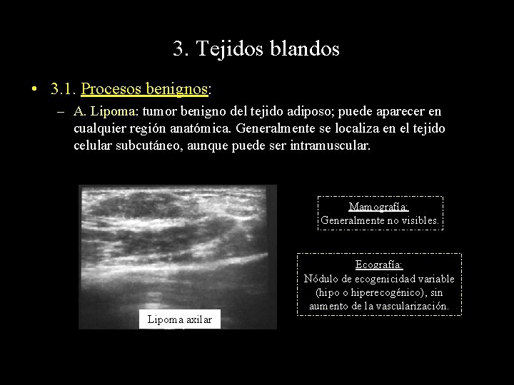 3. Tejidos blandos • 3. 1. Procesos benignos: – A. Lipoma: tumor benigno del