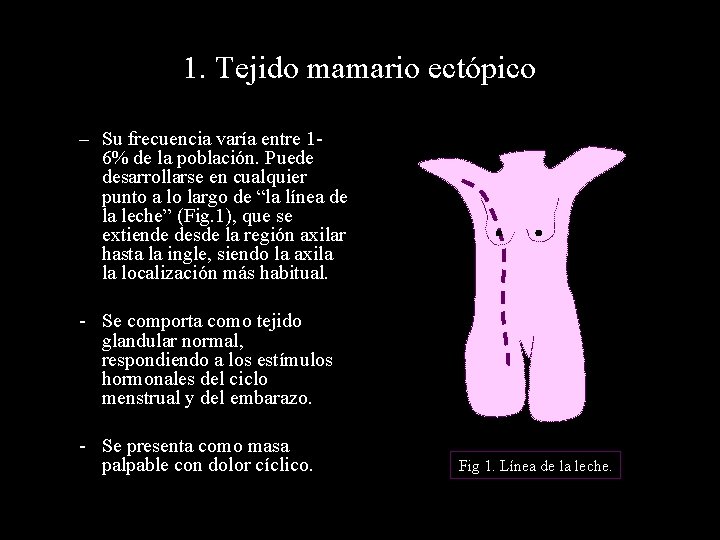 1. Tejido mamario ectópico – Su frecuencia varía entre 16% de la población. Puede