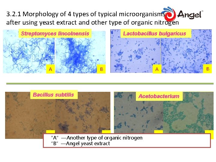 3. 2. 1 Morphology of 4 types of typical microorganisms after using yeast extract