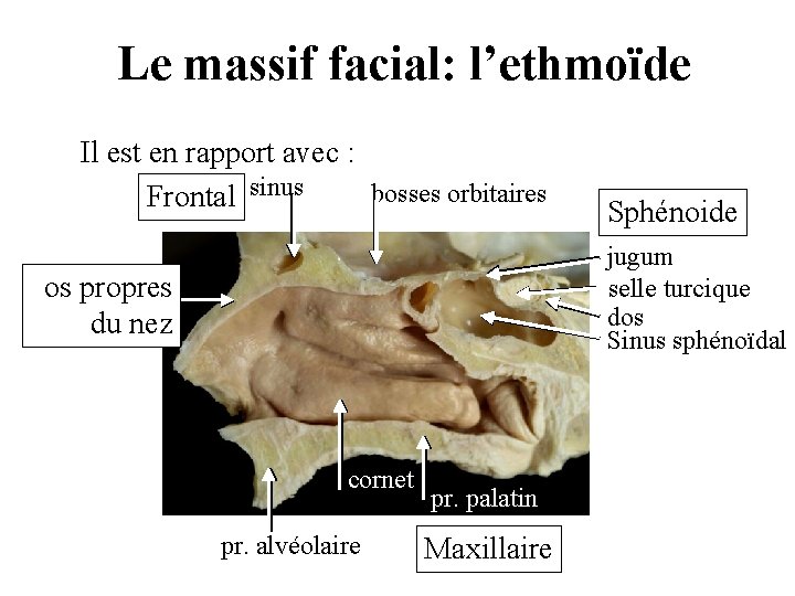 Le massif facial: l’ethmoïde Il est en rapport avec : bosses orbitaires Frontal sinus Le massif facial: l’ethmoïde Il est en rapport avec : bosses orbitaires Frontal sinus