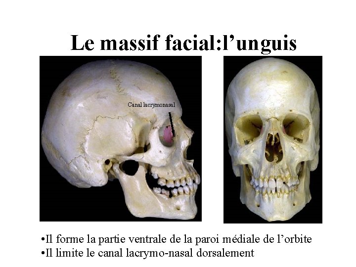 Le massif facial: l’unguis Canal lacrymonasal • Il forme la partie ventrale de la Le massif facial: l’unguis Canal lacrymonasal • Il forme la partie ventrale de la