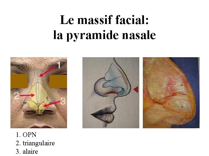 Le massif facial: la pyramide nasale 1. OPN 2. triangulaire 3. alaire Le massif facial: la pyramide nasale 1. OPN 2. triangulaire 3. alaire