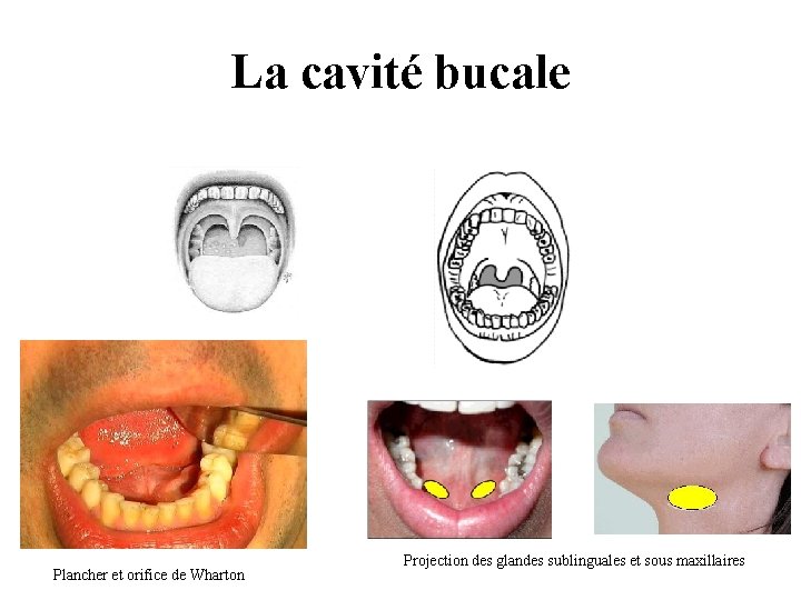 La cavité bucale Plancher et orifice de Wharton Projection des glandes sublinguales et sous La cavité bucale Plancher et orifice de Wharton Projection des glandes sublinguales et sous