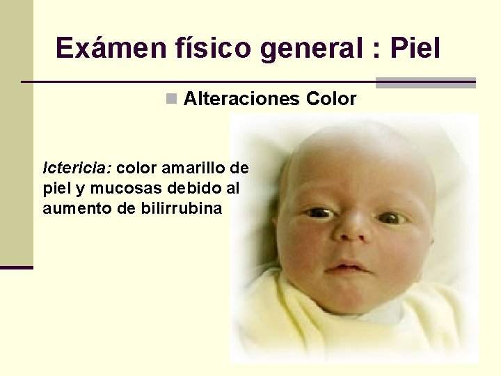Exámen físico general : Piel n Alteraciones Color Ictericia: color amarillo de piel y