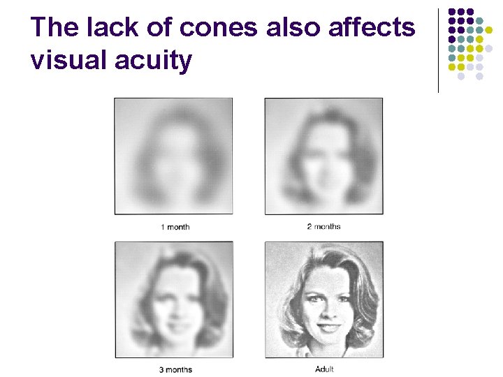 The lack of cones also affects visual acuity 