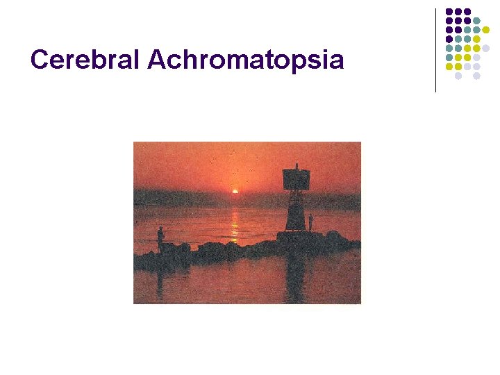 Cerebral Achromatopsia 