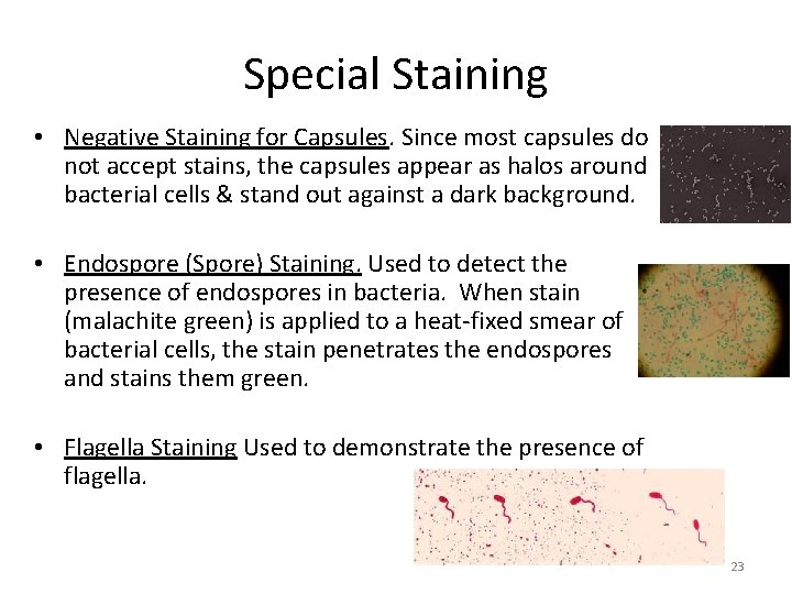 Special Staining • Negative Staining for Capsules. Since most capsules do not accept stains,