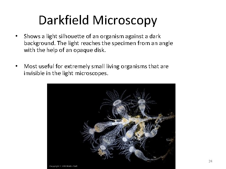 Darkfield Microscopy • Shows a light silhouette of an organism against a dark background.