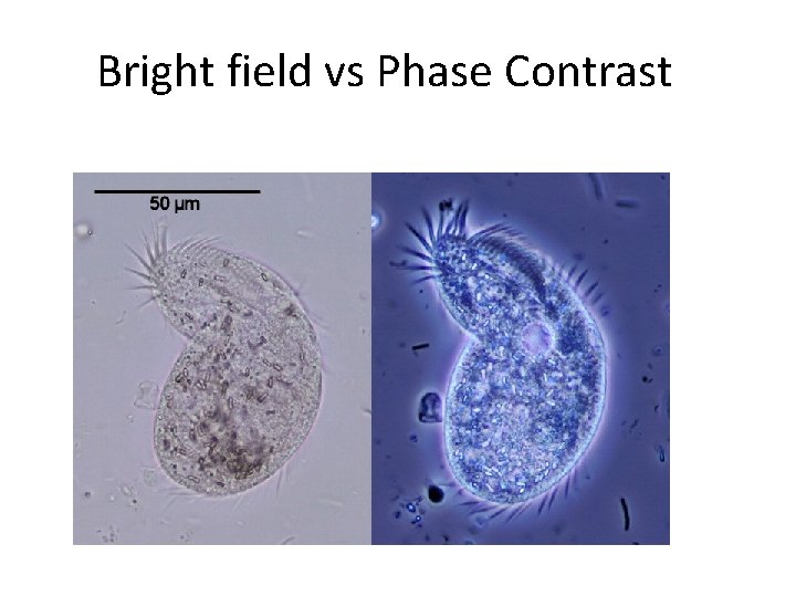 Bright field vs Phase Contrast 