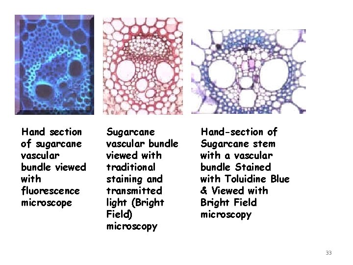 Hand section of sugarcane vascular bundle viewed with fluorescence microscope Sugarcane vascular bundle viewed