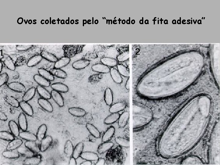 Ovos coletados pelo “método da fita adesiva” Ovos coletados pelo “método da fita adesiva”