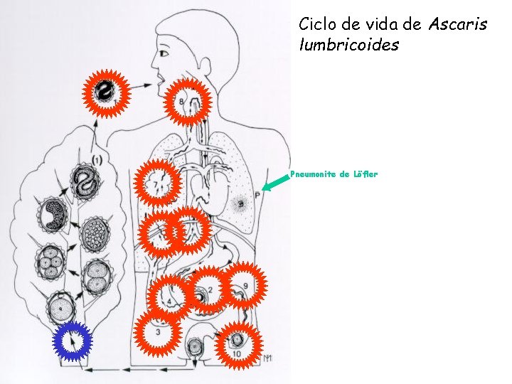 Ciclo de vida de Ascaris lumbricoides Pneumonite de Löfler Ciclo de vida de Ascaris lumbricoides Pneumonite de Löfler