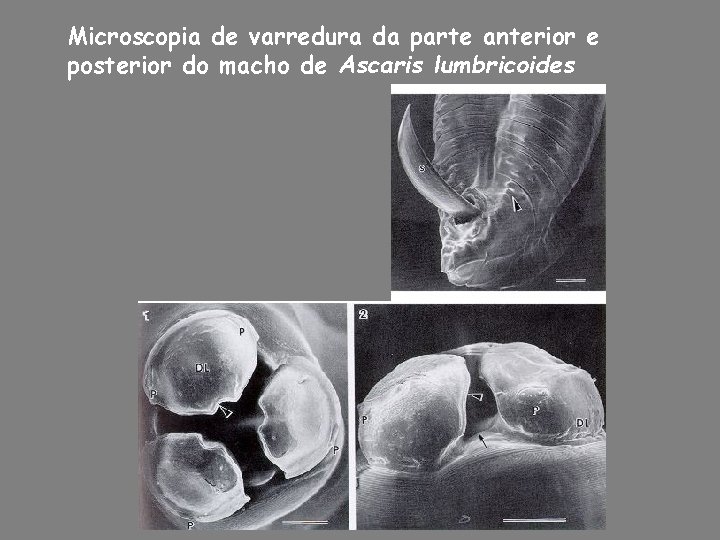 Microscopia de varredura da parte anterior e posterior do macho de Ascaris lumbricoides Microscopia de varredura da parte anterior e posterior do macho de Ascaris lumbricoides