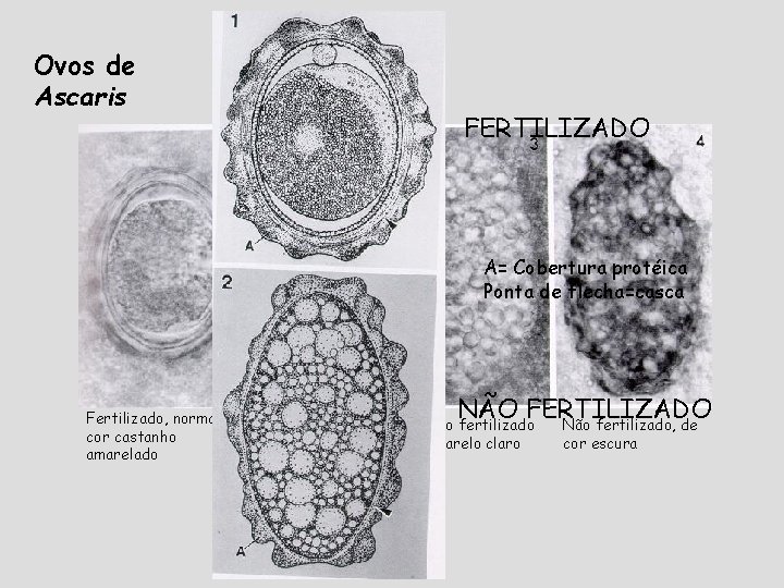 Ovos de Ascaris FERTILIZADO A= Cobertura protéica Ponta de flecha=casca Fertilizado, normal, cor castanho Ovos de Ascaris FERTILIZADO A= Cobertura protéica Ponta de flecha=casca Fertilizado, normal, cor castanho