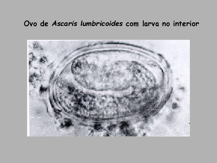 Ovo de Ascaris lumbricoides com larva no interior Ovo de Ascaris lumbricoides com larva no interior